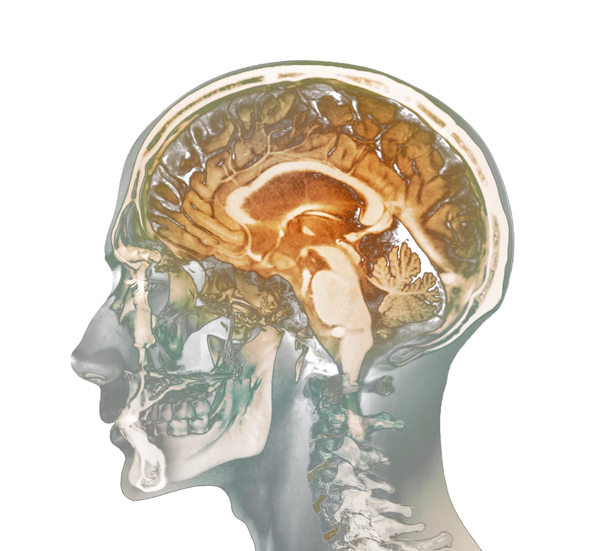 Brain activation scan