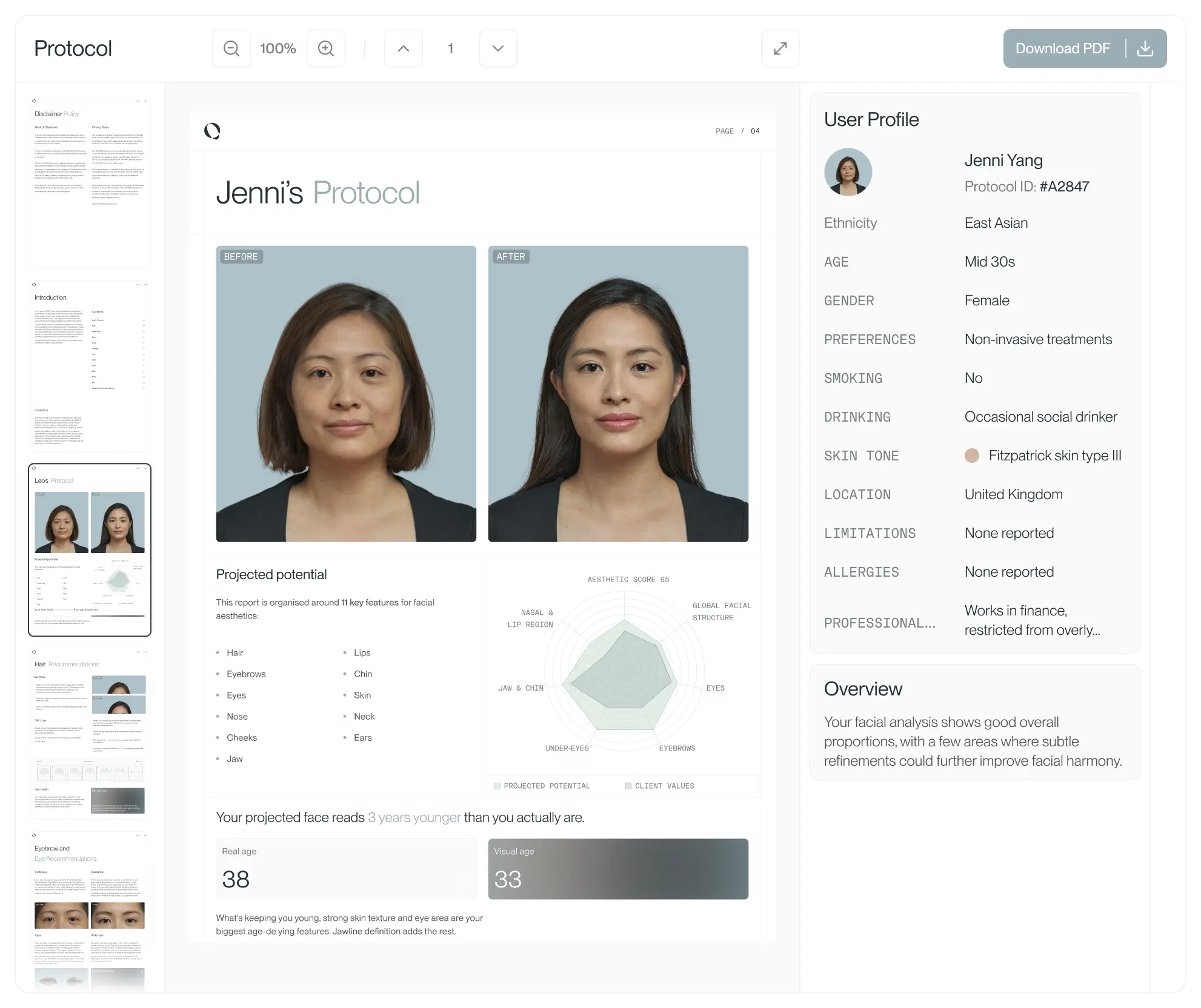 Qoves report viewer showing a personalized analysis report